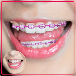 Braces – Selfie Camera иконка