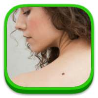 Skin Cancer on 9Apps