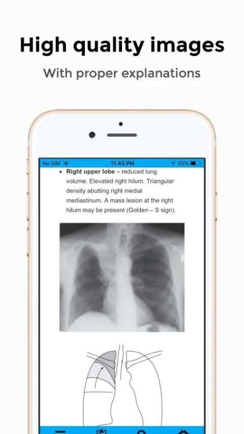 CXR FlashCards - Reference app for Chest X-rays скриншот 8