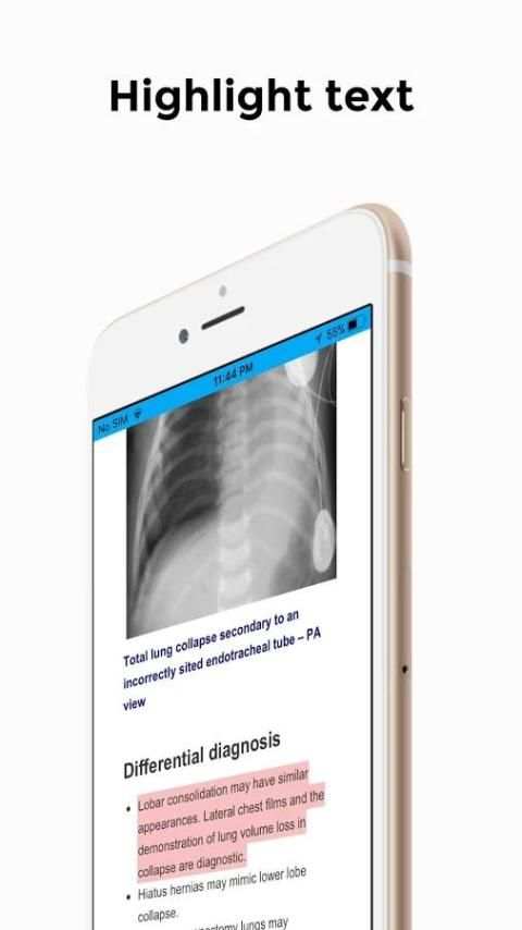 CXR FlashCards - Reference app for Chest X-rays screenshot 6