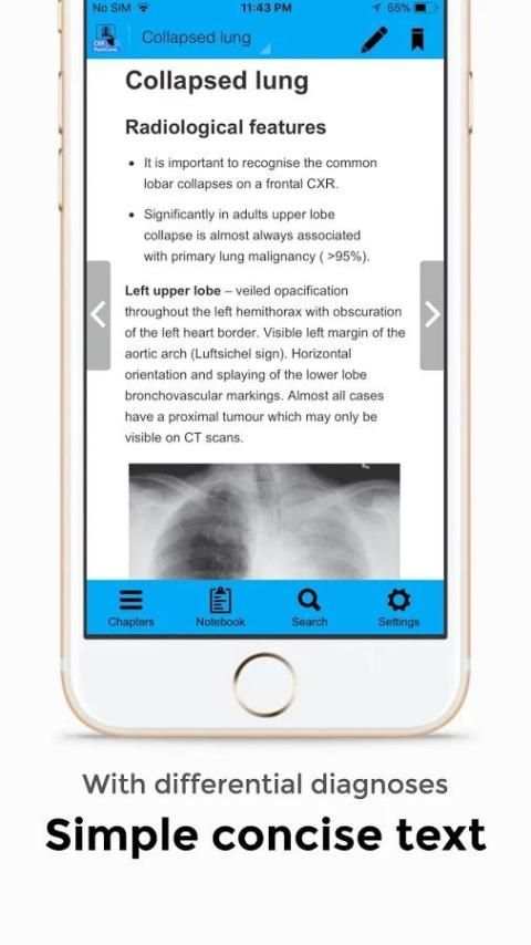 CXR FlashCards - Reference app for Chest X-rays screenshot 7