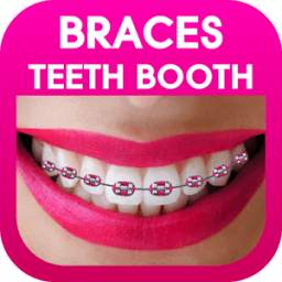 Braces Photo Editor