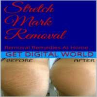 Stretch Mark Removal