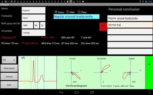 Mobile ecg recording screenshot 4