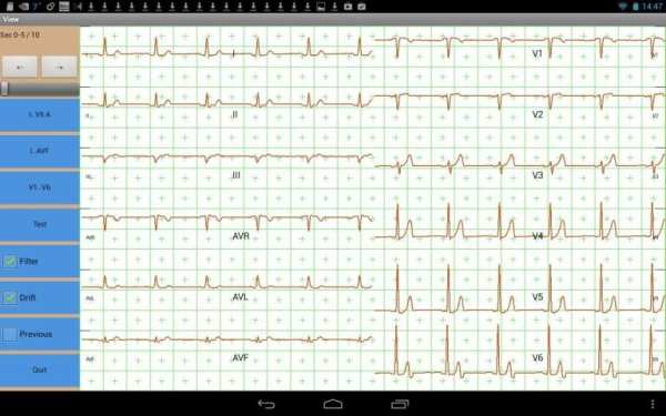 Mobile ecg recording screenshot 6