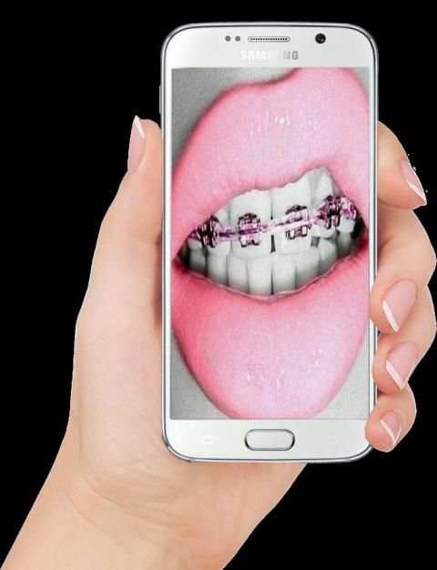 Real Braces teeth Selfie Camer screenshot 4