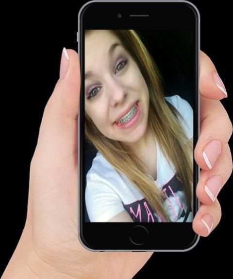 Real Braces teeth Selfie Camer screenshot 6