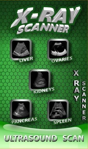 x-ray scanner скриншот 2