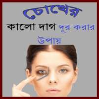 চোখের কালো দাগ দূর করার উপায় on 9Apps