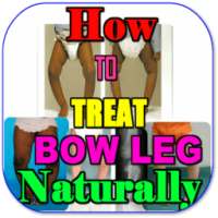 How To Fix Bow Legs Naturally on 9Apps