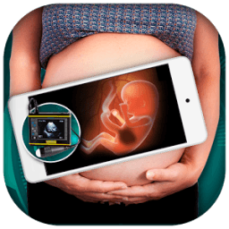 ikon X ray Pregnant Scanner Prank