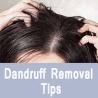 Dandruff Removal Tips - रूसी हटाने के उपाय on 9Apps