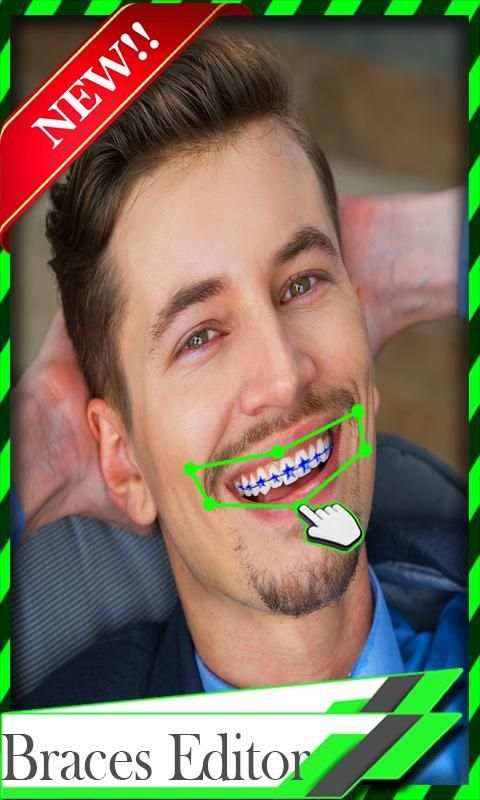 Braces Teeth Camera screenshot 4