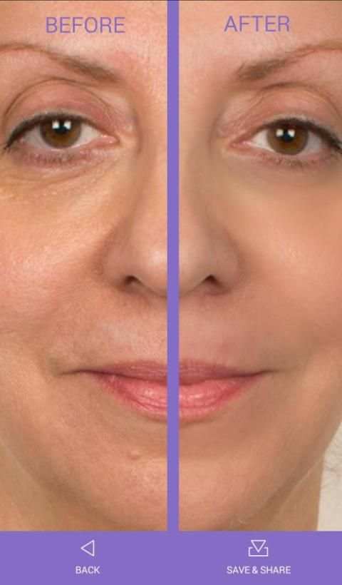 FaceLift 5 تصوير الشاشة