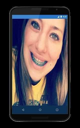 Top Disegn Braces Teeth Camera स्क्रीनशॉट 6