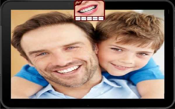 Top Disegn Braces Teeth Camera स्क्रीनशॉट 2