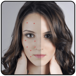 Acne Remover Zit remover Pimple Eraser иконка