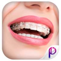 Braces Teeth Photo Editor