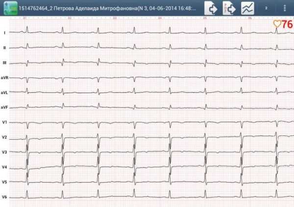 Easy ECG Mobile PRO screenshot 11