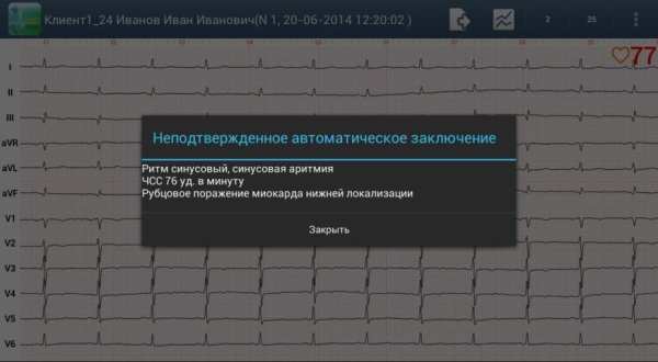 Easy ECG Mobile PRO screenshot 3