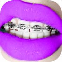 Braces on Photo Editor - Real Braces Teeth Pro