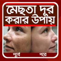 মেছতা দূর করার উপায় - mechta dur korar upay