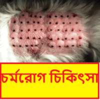 চর্মরোগ | Dermatitis