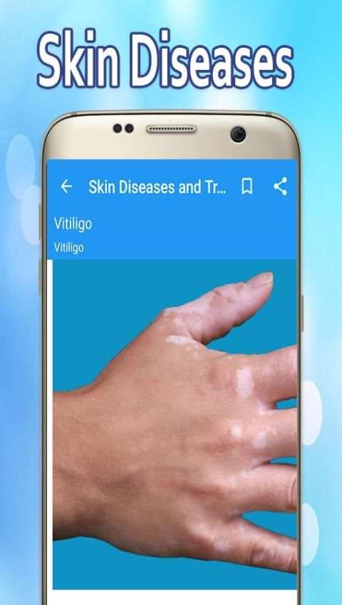 Skin Diseases and Treatment screenshot 2