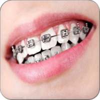 Real Braces Teeth Booth Pro on 9Apps