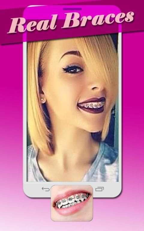 Real Braces Teeth Booth Pro 5 تصوير الشاشة