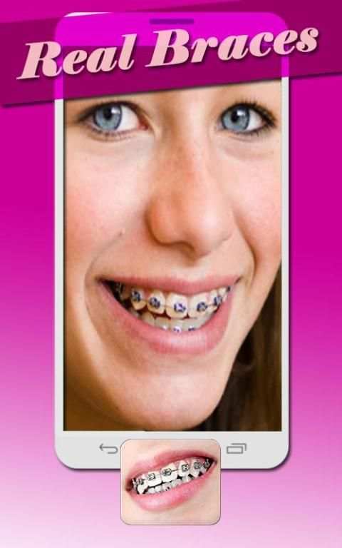 Real Braces Teeth Booth Pro 3 تصوير الشاشة