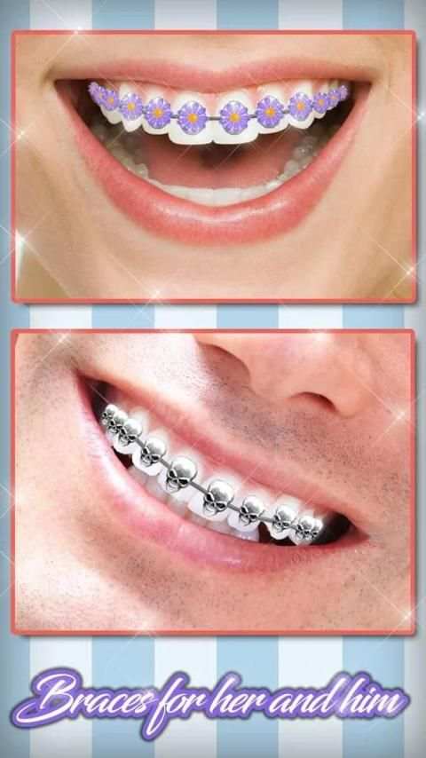 Braces Teeth Booth Camera App screenshot 12