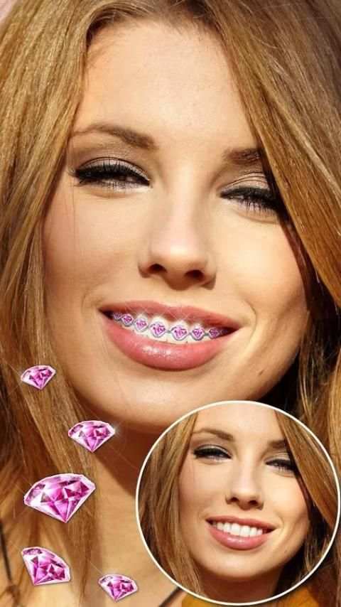 Braces Teeth Booth Camera App screenshot 10