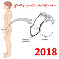 ضعف الإنتصـاب الأسباب والعلاج 2018