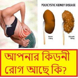 কিডনি সমস্যার সমাধান ~ Kidney stones solution أيقونة