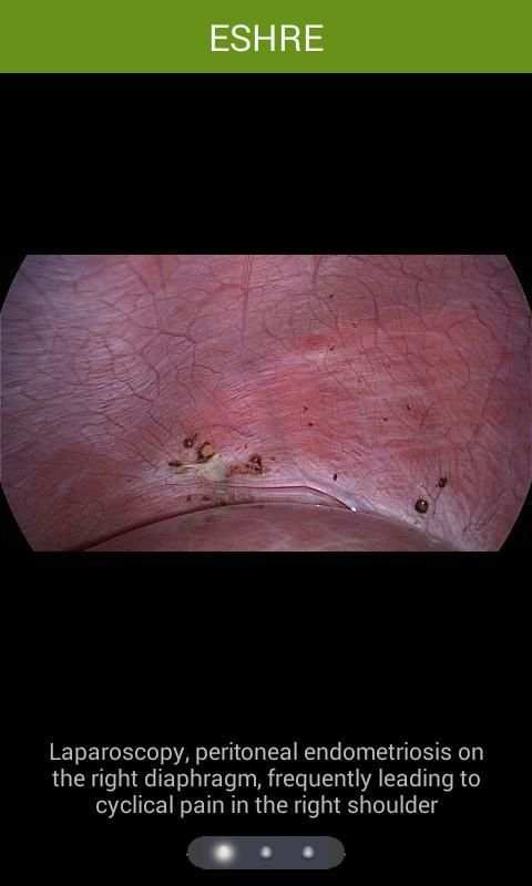 Endo App 2 تصوير الشاشة