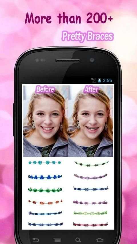 Braces screenshot 3