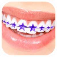 Braces Camera Editor on 9Apps