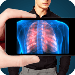 ikon Girls Body Scanner Prank