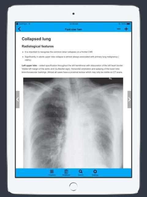 CXR FlashCards - Reference app for Chest X-rays скриншот 1