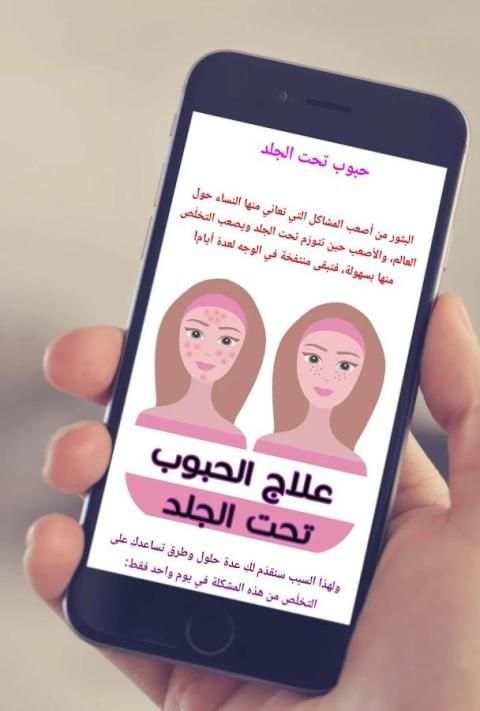 10 طرق لعلاج الحبوب تحت الجلد screenshot 1