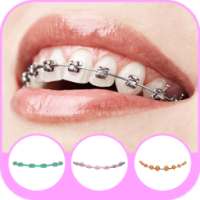 Braces on Photo-Collage Photo