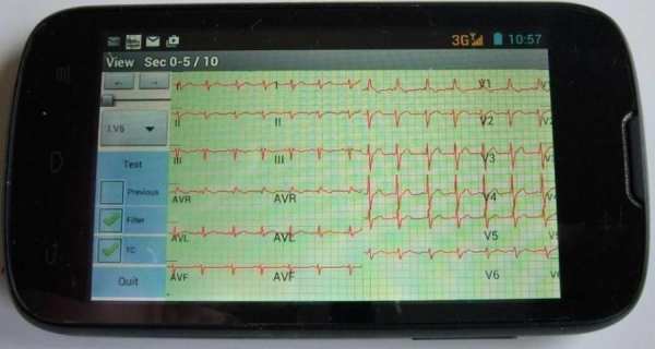 Mobile ecg recording screenshot 7