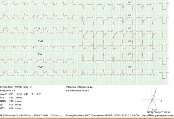 Mobile ecg recording screenshot 1