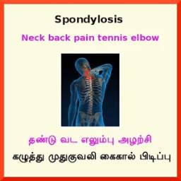 Spondylosis Spondylitis