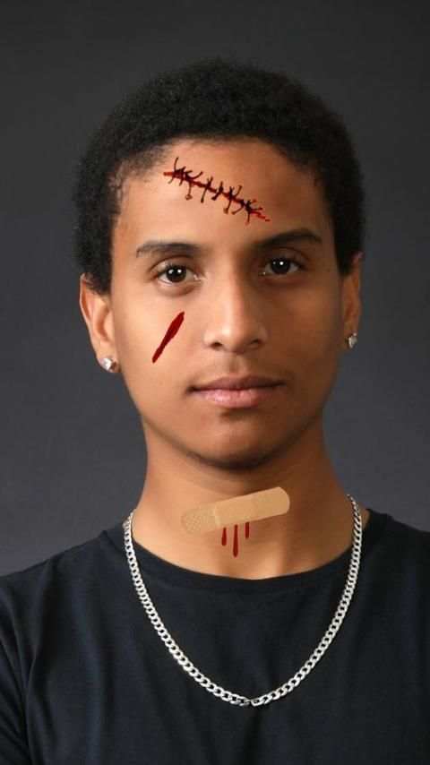 Injury Photo Editor скриншот 3
