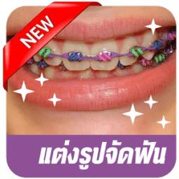 Selfie Braces Teeth Booth App