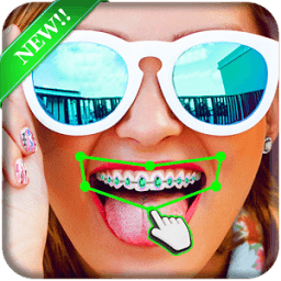 ikon Braces Teeth Camera