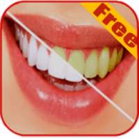 Teeth Whitening Tips on 9Apps