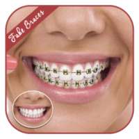 Fake Braces - Face Photo Editor